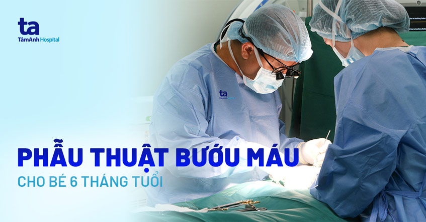 phẫu thuật bướu máu cho bé 6 tháng tuổi