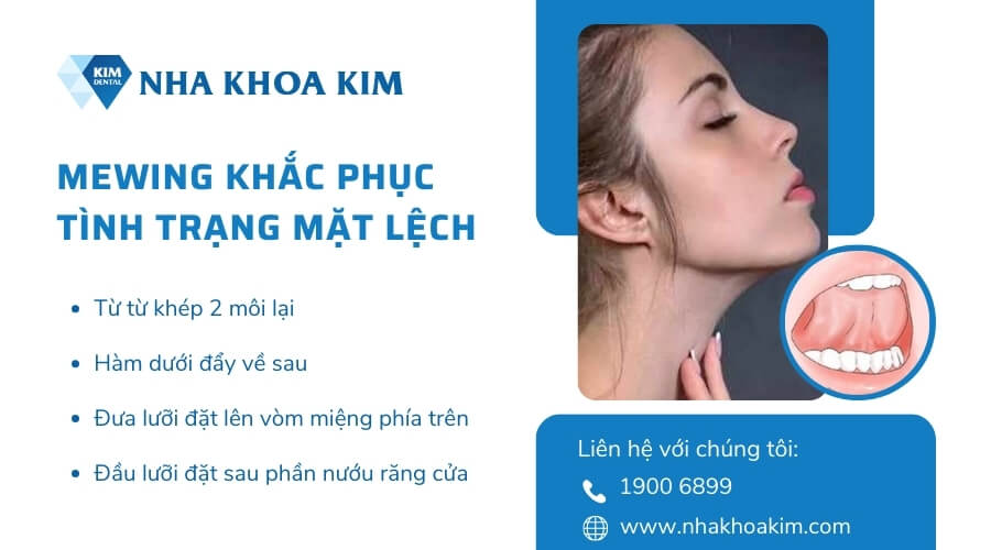 Tập Mewing khắc phục tình trạng mặt lệch hiệu quả