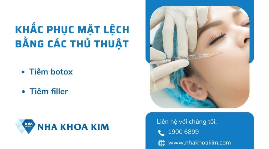 Khắc phục mặt lệch hiệu quả bằng phương pháp tiêm botox hoặc filler