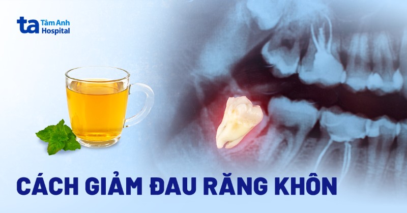 cách giảm đau răng khôn