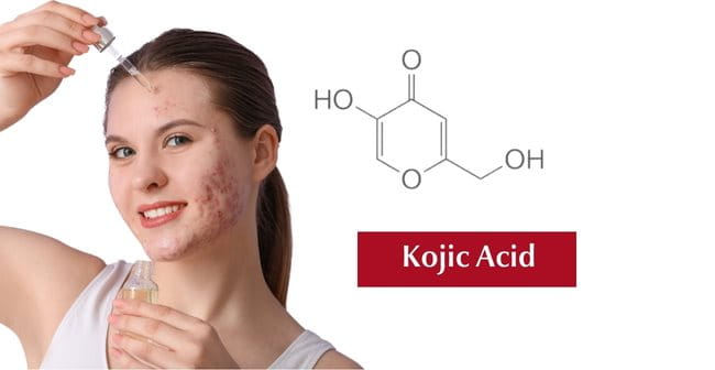 Cách trị vết thâm mụn lâu năm bằng Kojic acid