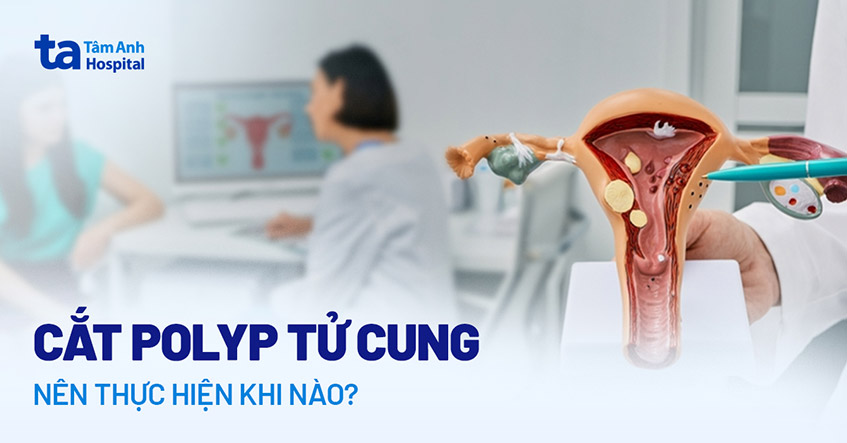 phẫu thuật cắt polyp tử cung