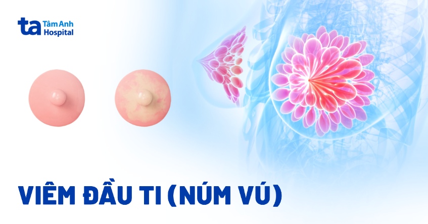 Viêm đầu ti