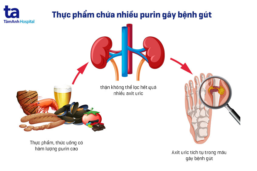 thực phẩm chứa nhiều purin