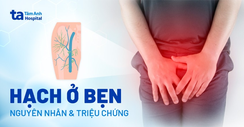 Nổi hạch ở bẹn