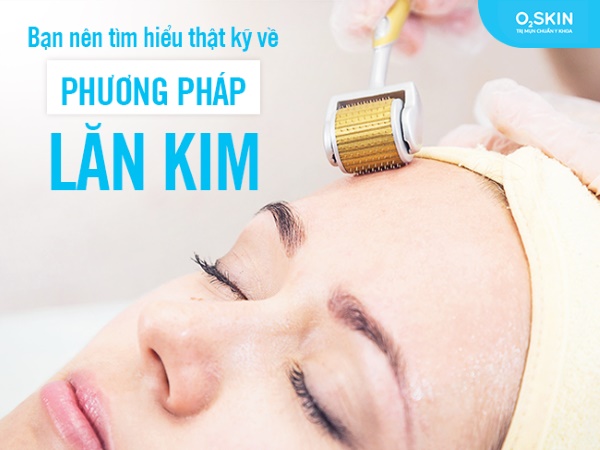 <span style="font-family: arial, helvetica, sans-serif;">Lăn kim - phương pháp điều trị sẹo rỗ hiệu quả nhất hiện nay.</span>