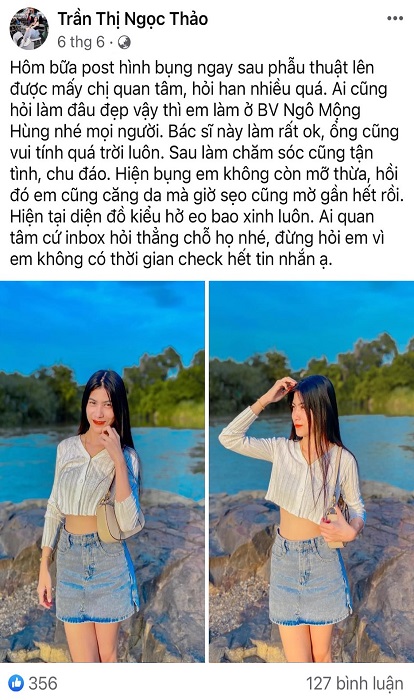 Chi phí hút mỡ bụng