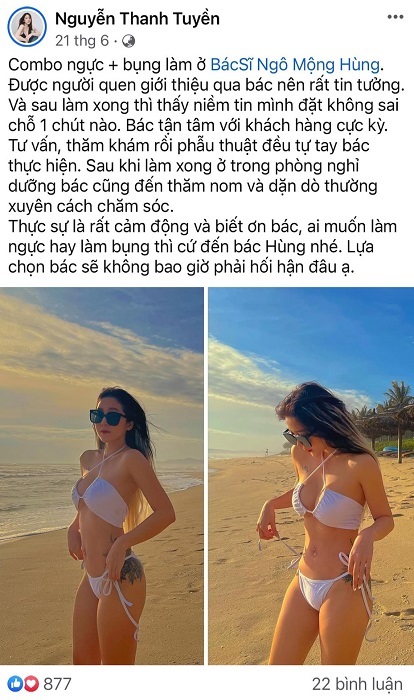 Chi phí hút mỡ bụng