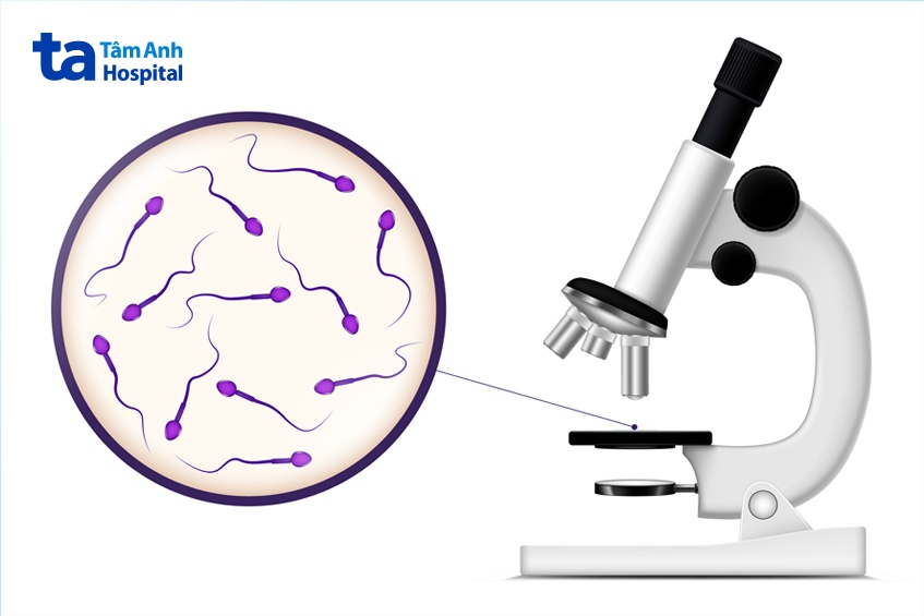 kết quả xét nghiệm tinh dịch đồ dưới kính hiển vi