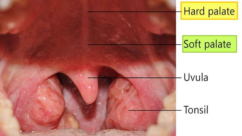 Soft palate là gì? Cấu tạo và chức năng của soft palate 1