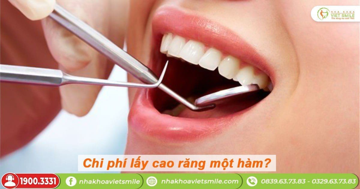 Chi phí lấy cao răng một hàm