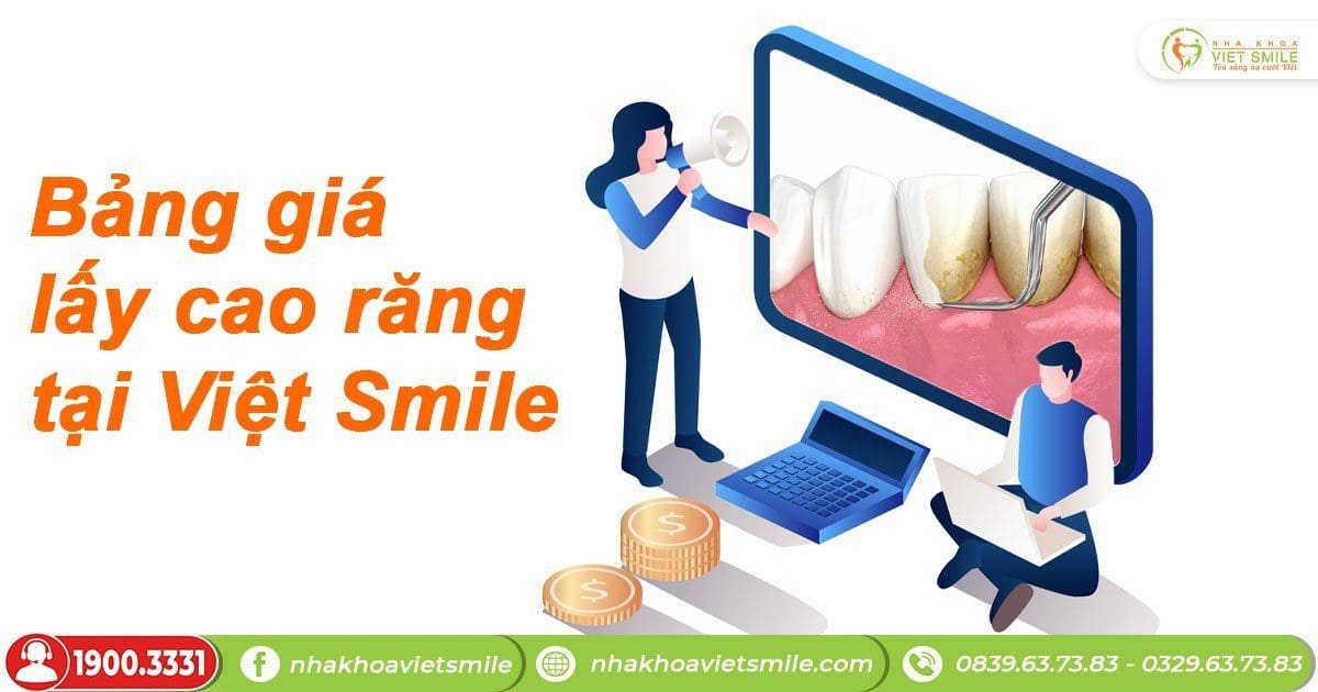 Bảng giá lấy cao răng tại Việt Smile