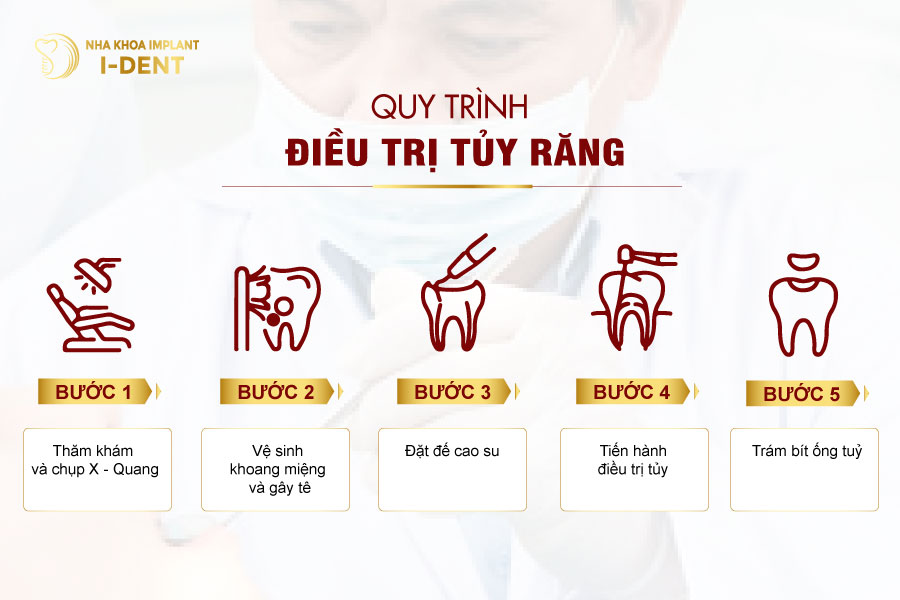 Quy trình lấy tủy tại Nha khoa I - DENT