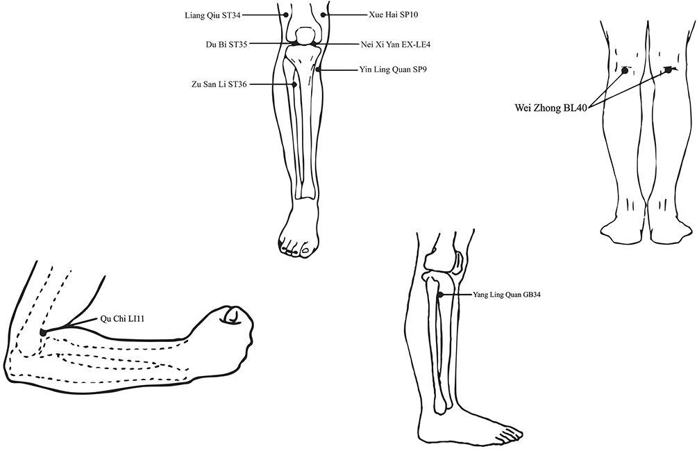 Manual Acupuncture at LI11, Local Points and Both for Knee Osteoarthritis: A Pilot Randomized Controlled Trial