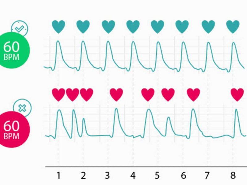 Mạch đập bình thường là bao nhiêu? Khi nào được cho là bất thường 4
