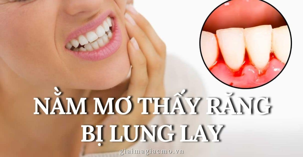 Nằm Mơ Thấy Răng Bị Lung Lay