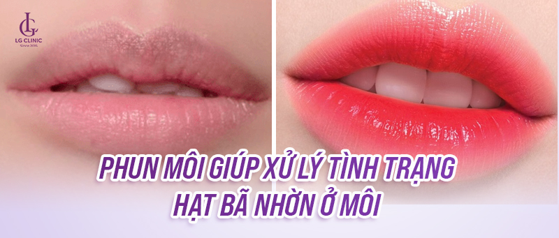 Phun môi giúp xử lý tình trạng hạt bã nhờn ở môi