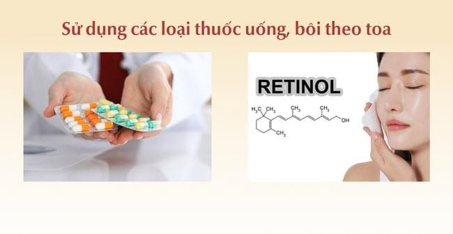 Sử dụng các loại thuốc uống, bôi kê đơn điều trị mặt nổi mụn trắng nhỏ