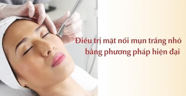 Điều trị mặt nổi mụn trắng nhỏ bằng liệu pháp công nghệ cao