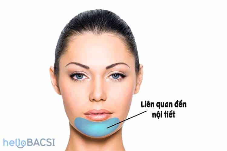 mụn ẩn trên trán và mụn mọc dưới cằm