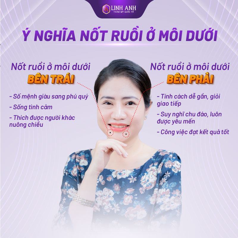 nốt ruồi ngay miệng