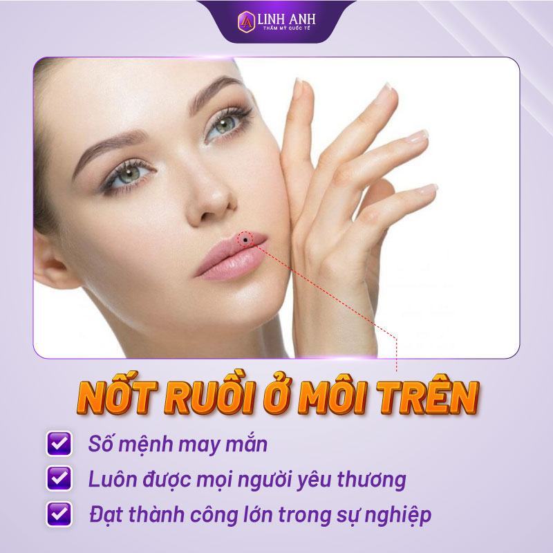 nốt ruồi trên miệng