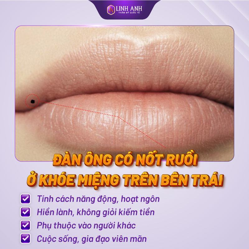 nốt ruồi ở gần miệng