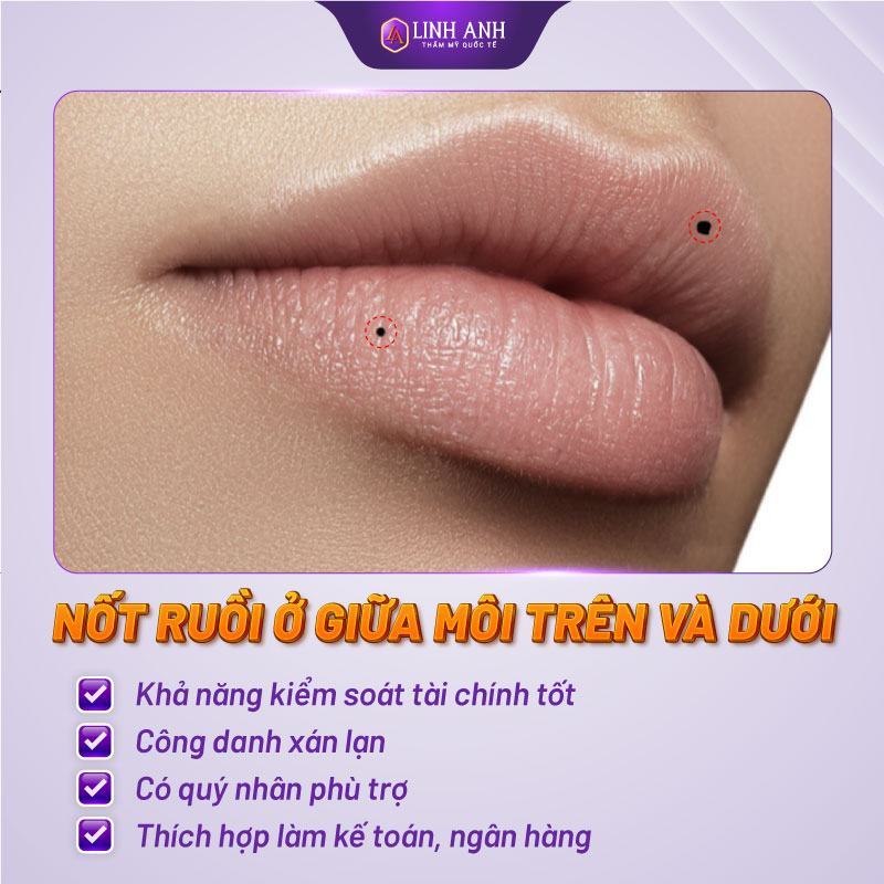 nốt ruồi trên miệng bên phải