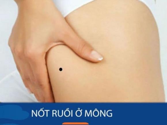 Nốt ruồi, nốt ruồi ở mông, xem tướng qua nốt ruồi