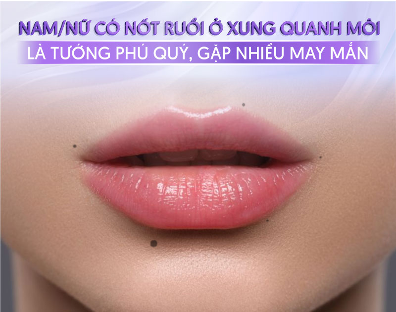 nốt ruồi môi trên