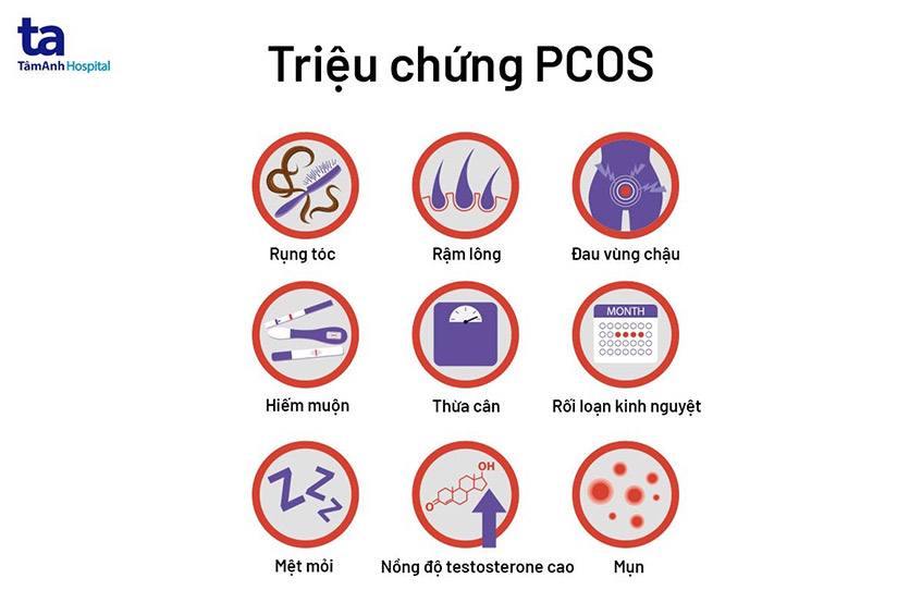 triệu chứng pcos