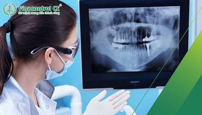 X-ray hình nha khoa sử dụng tia X để tạo ra hình ảnh của răng