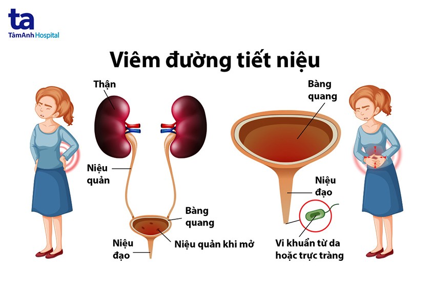 bàng quang và thận