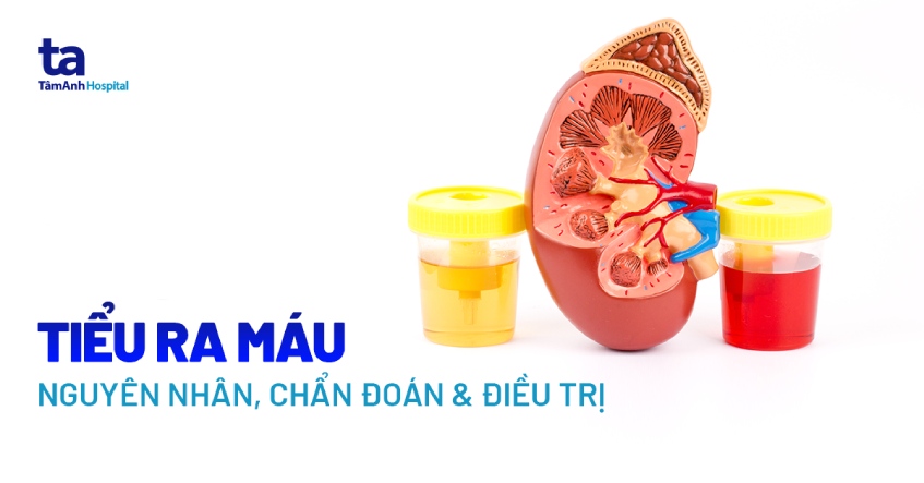 đi tiểu ra máu