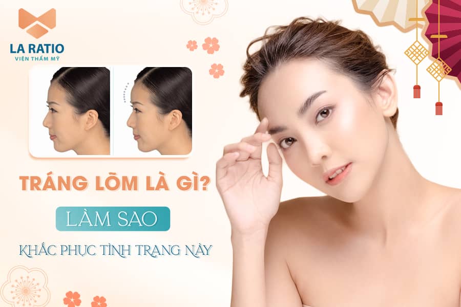 Trán lõm là gì? Làm sao khắc phục tình trạng lõm trán