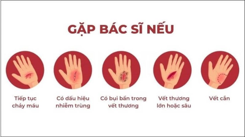 Các tình huống té xe trầy chân cần đến bệnh viện ngay lập tức