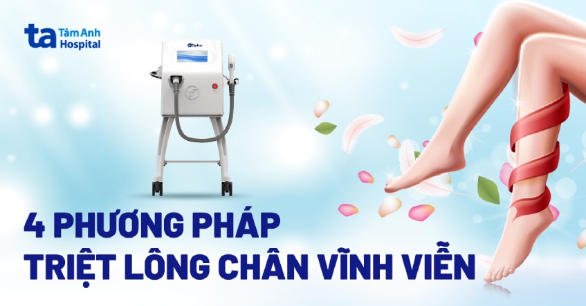 triệt lông chân vĩnh viễn