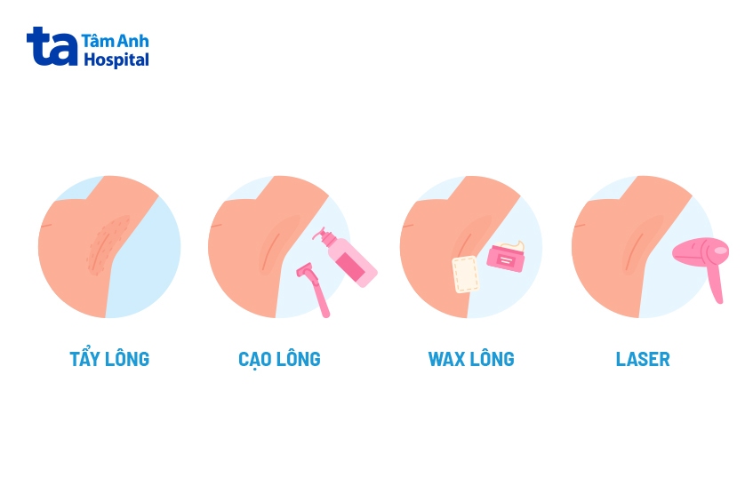 có nên triệt lông nách vĩnh viễn không