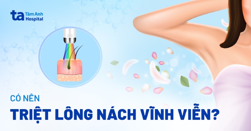 triệt lông nách