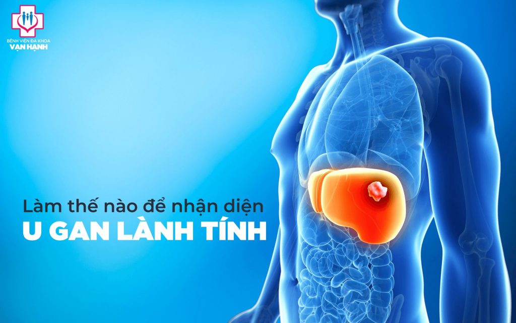 u gan lành tính có biểu hiện gì