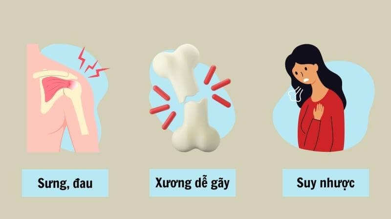 Ung thư xương là gì? Nguyên nhân, dấu hiệu, biến chứng và điều trị