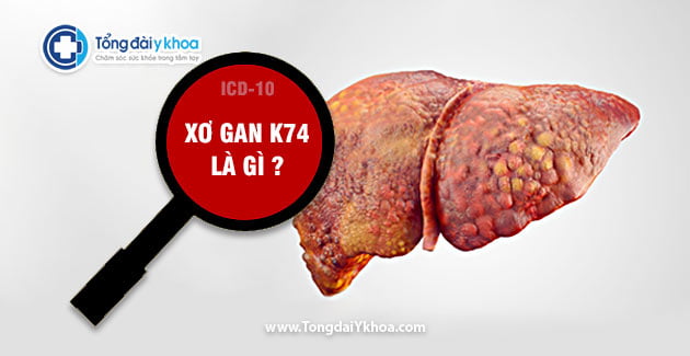 ma benh xo gan k74 la gi icd-10