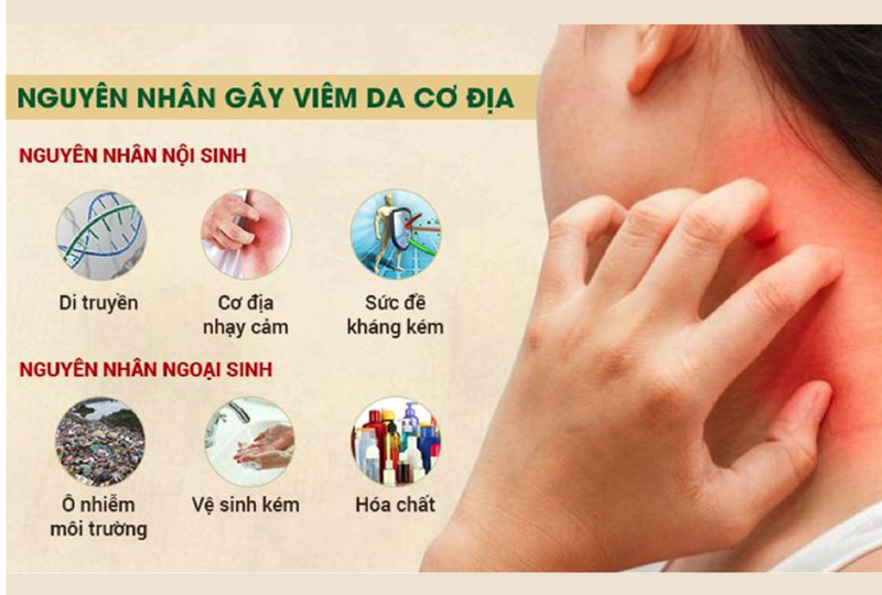 Bệnh da liễu là gì? Nguyên nhân gây bệnh da liễu 3