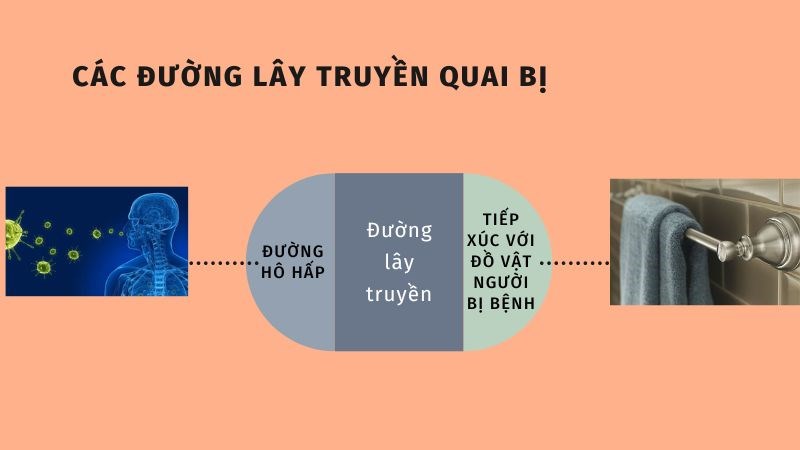 Các đường lây truyền của quai bị