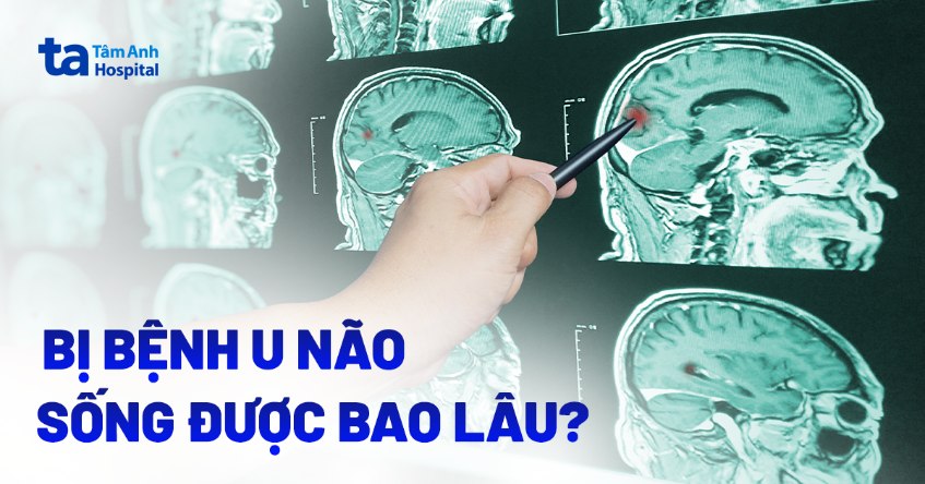 bệnh u não sống được bao lâu