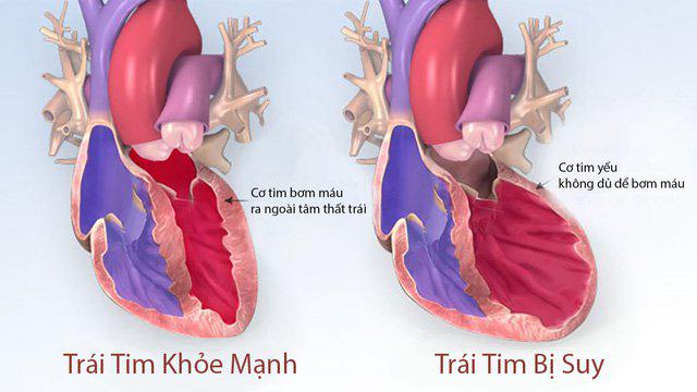 7 bệnh tim mạch thường gặp và các triệu chứng