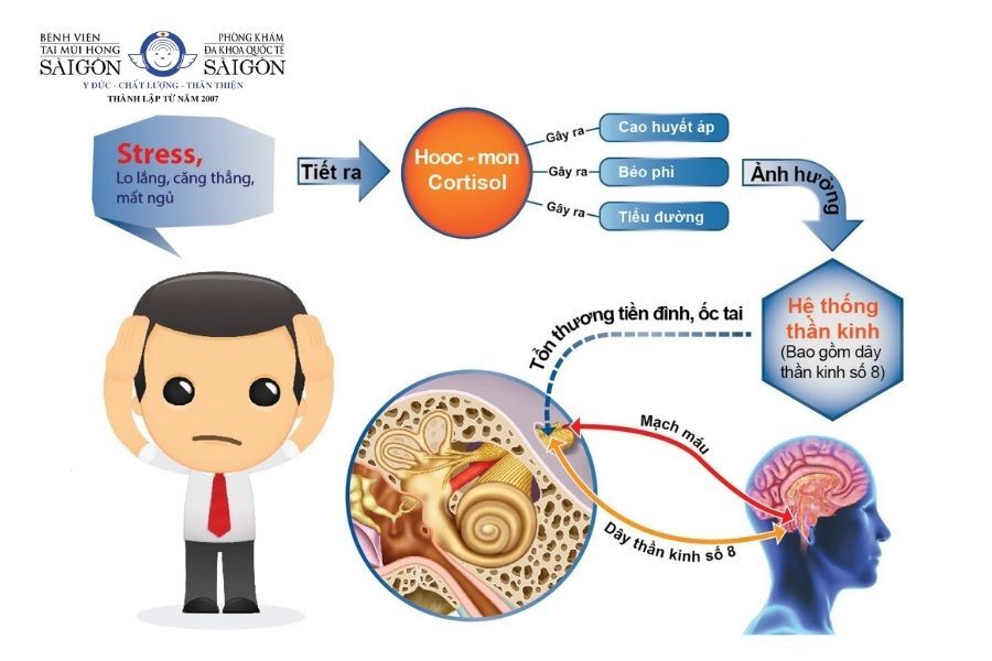 Nên làm gì khi bị rối loạn tiền đình