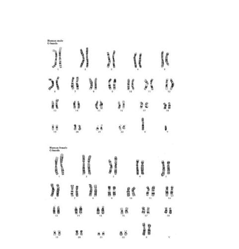 Hình 1. Karyotype bình thường ở nam giới và nữ giới (Cytogenetics Gallery)