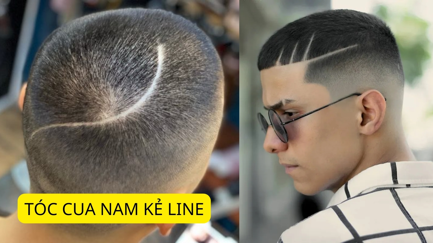 tóc cua nam kẻ line