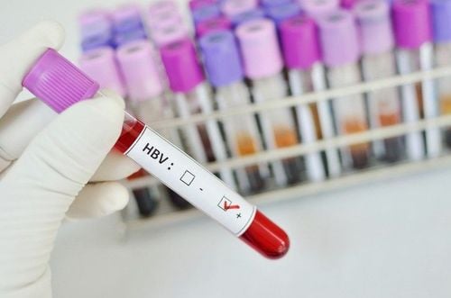 Khi kết quả xét nghiệm HBV-DNA âm tính có nghĩa là xét nghiệm này không thể thấy được virus viêm gan B trong cơ thể